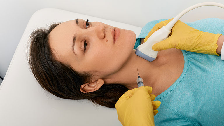 Fine-Needle Aspiration